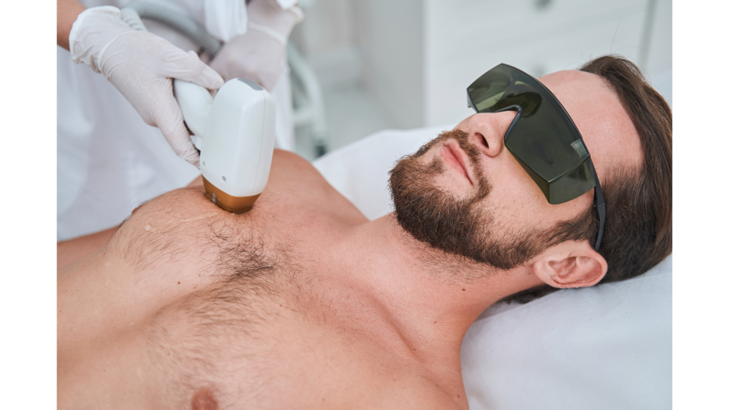 laser hair removal 