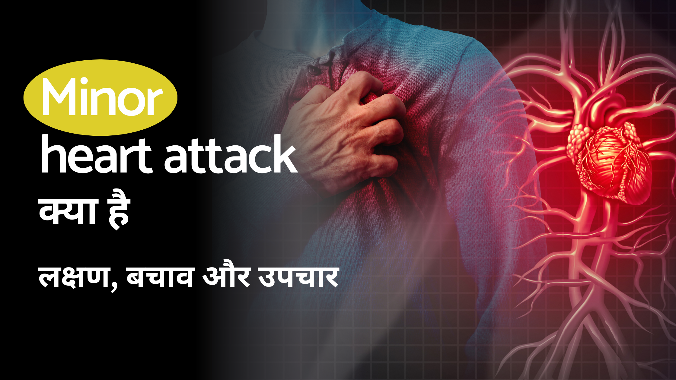 Minor heart attack: माइनर हार्ट अटैक