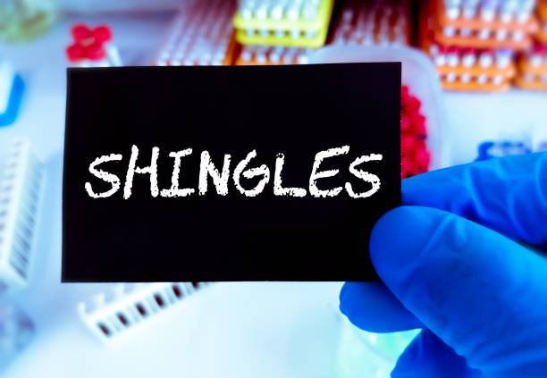 Shingles disease: हरपीज (Shingles)
